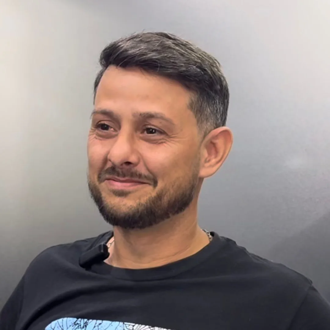 Cliente 03 depois da prótese capilar
